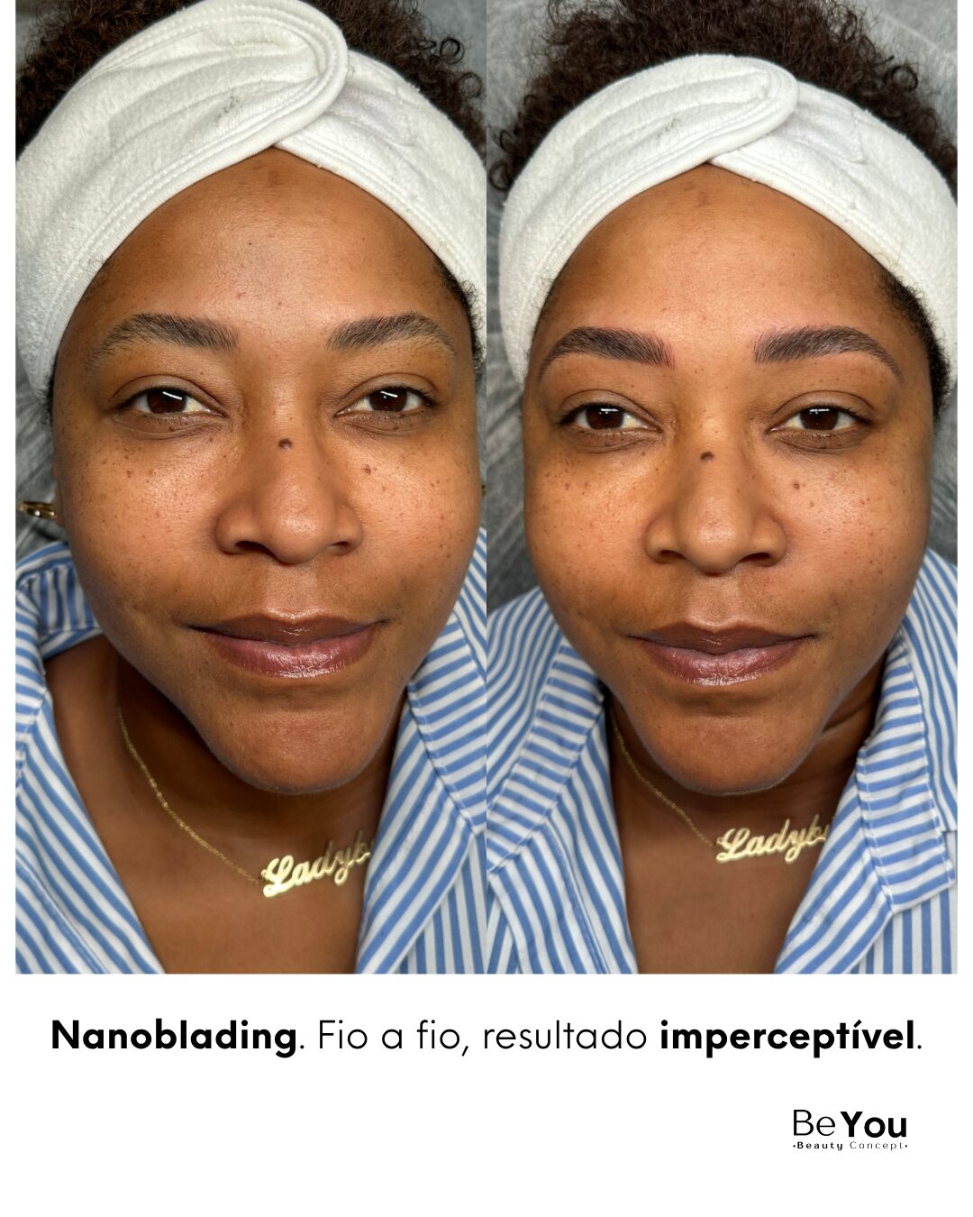 Antes e depois — Nanoblading Be You, resultado fio a fio imperceptível