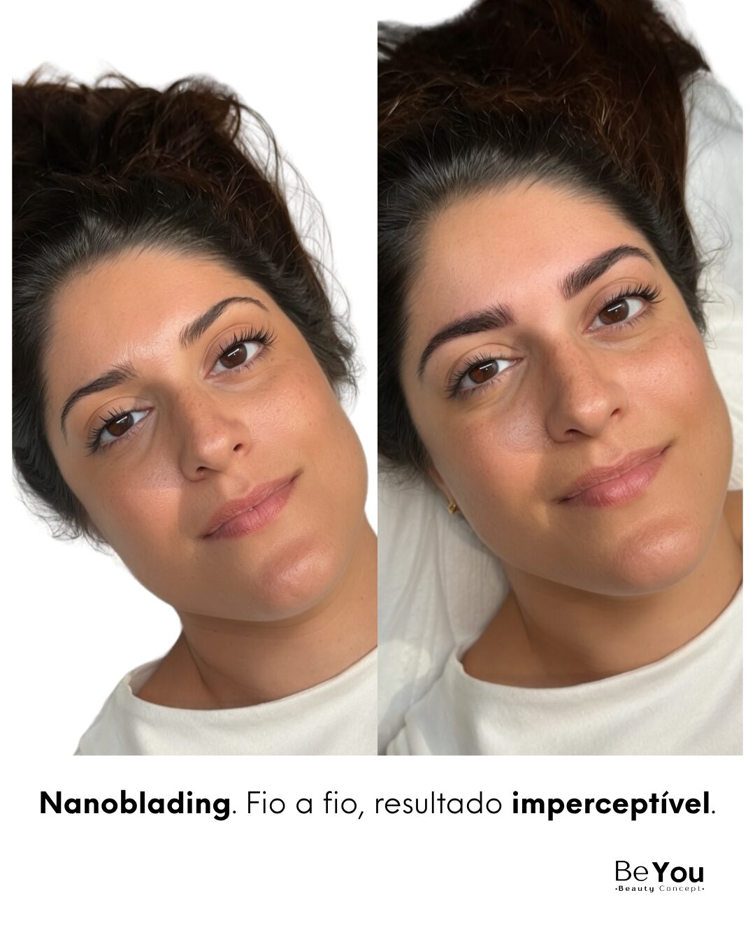 Antes e depois — Nanoblading Be You, resultado imperceptível